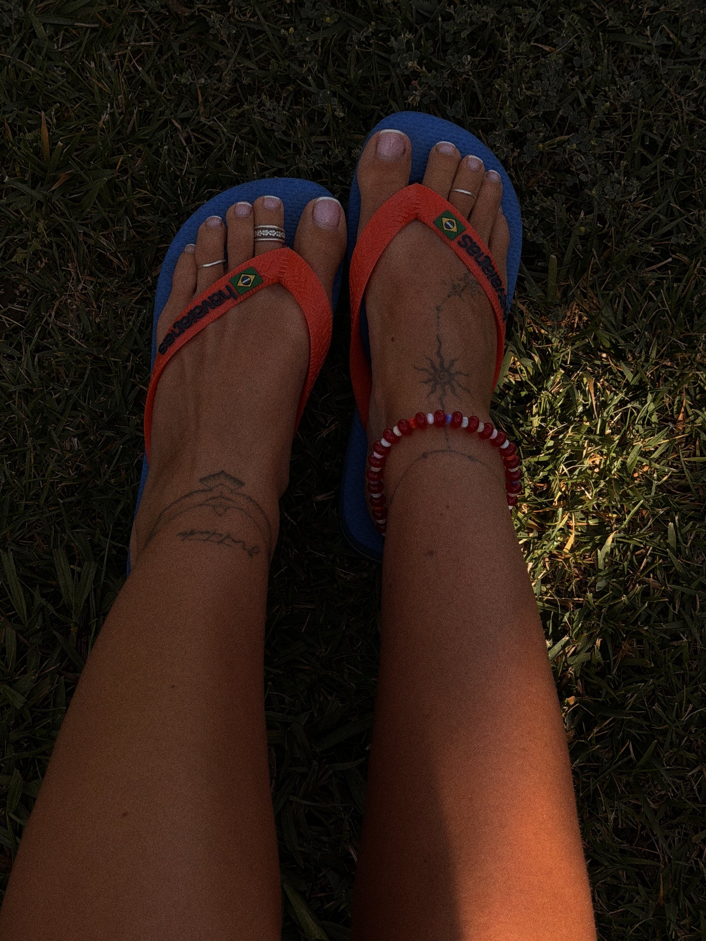 SUNBURN